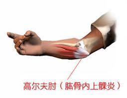 肱骨内上髁注射