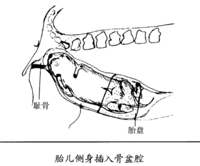 <p>生产过程1