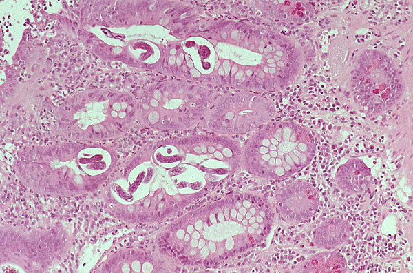 神经特异性烯醇化酶