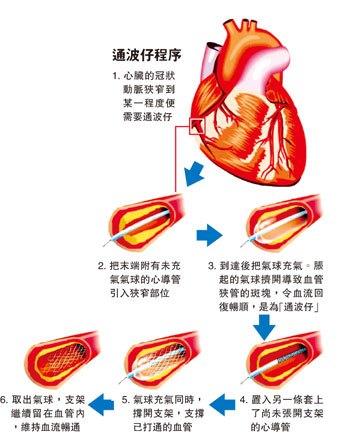 通波仔_百度百科