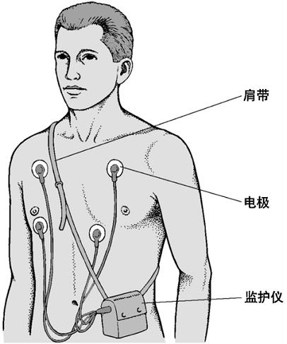 24小时心电图
