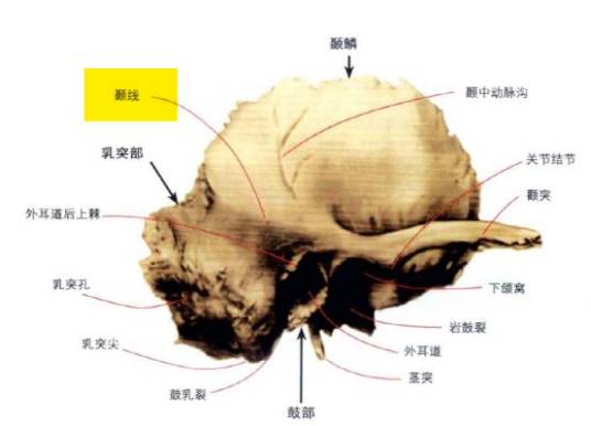 颞线_百度百科