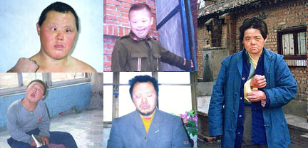 世界唐氏综合征日