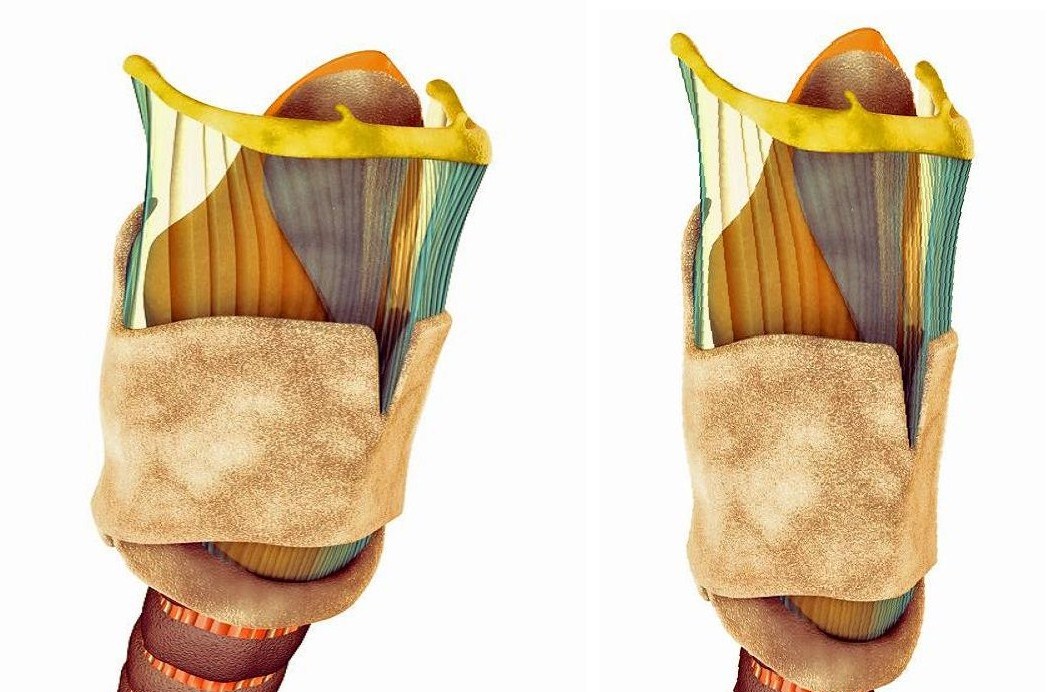  p>1,甲状软骨是喉软骨中最大的一个,由左右两个四边形软骨板构成喉的