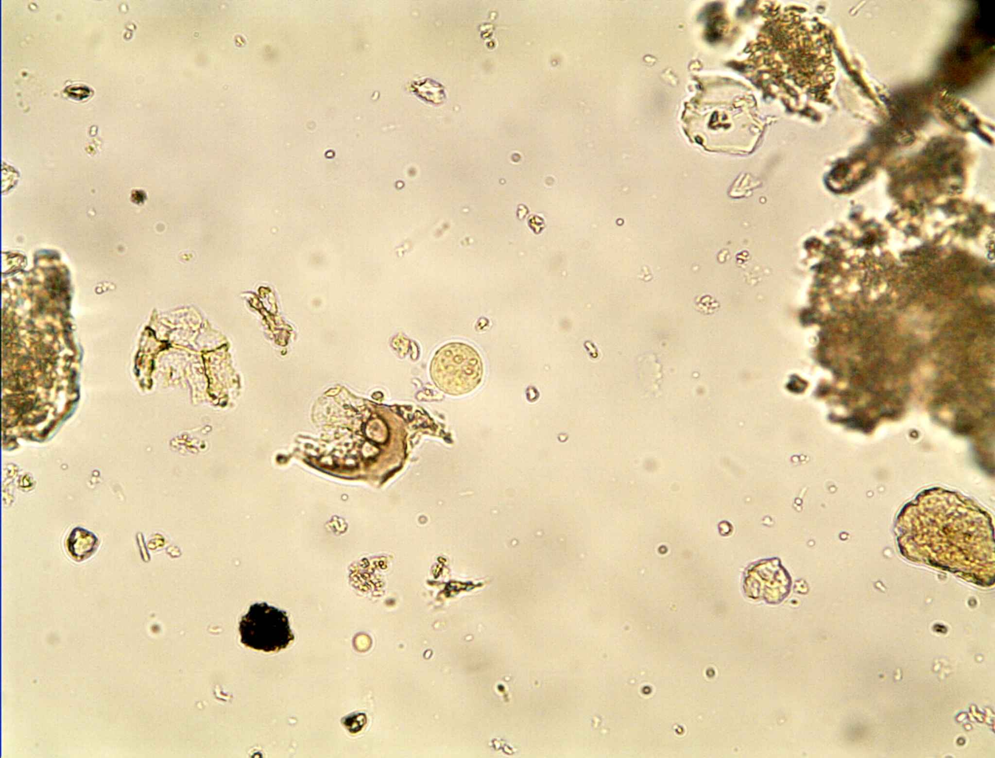  p>溶组织内阿米巴(entamoeba histolytica schaudinn, 1903)属内