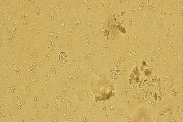 堆形艾美耳球虫早熟株