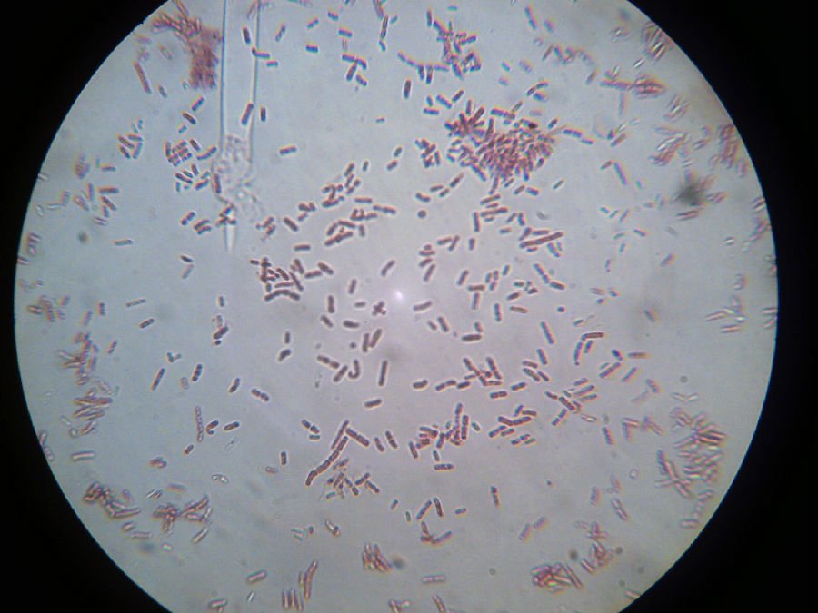 蜡样芽孢杆菌(学名:bacillus cereus),又称仙人掌杆菌,是一种革兰