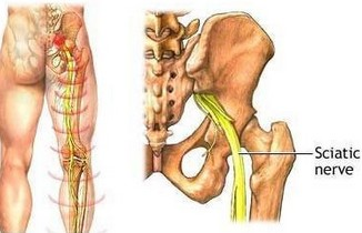 睡后手指出现麻木或烧灼痛而致醒