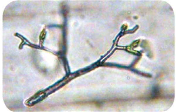 ="ref" data-ctrid="sts7vz7vgfyn">南瓜霜霉病是由古巴假霜霉引起