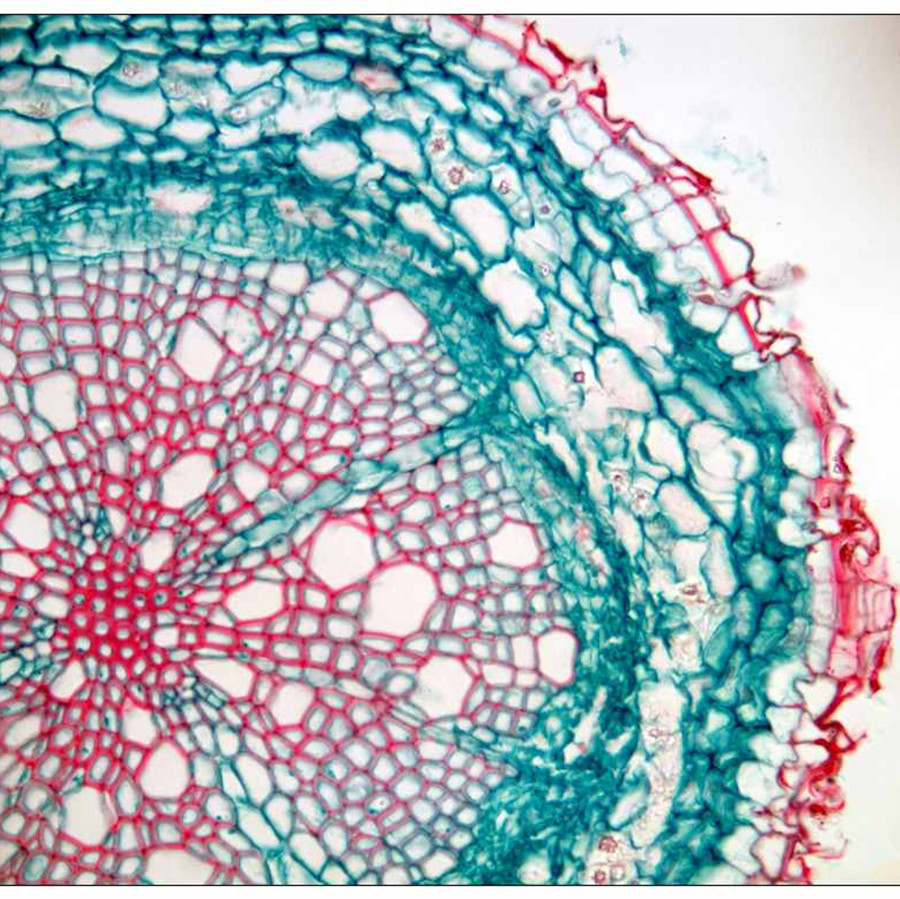  p>周皮是取代表皮的次生 a target="_blank" href="/item/保护组织
