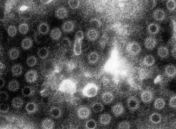 溶血性链球菌感染