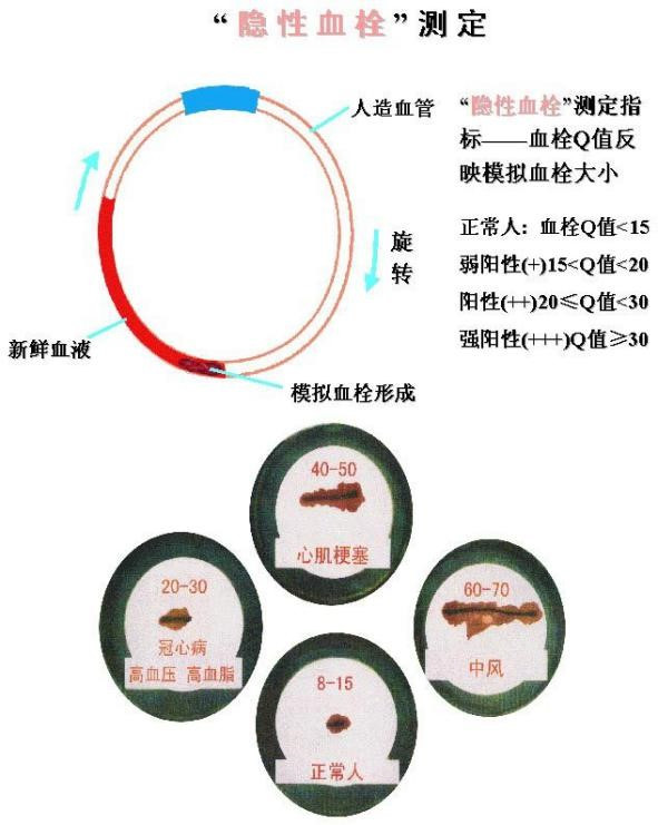 血栓检测仪_百度百科
