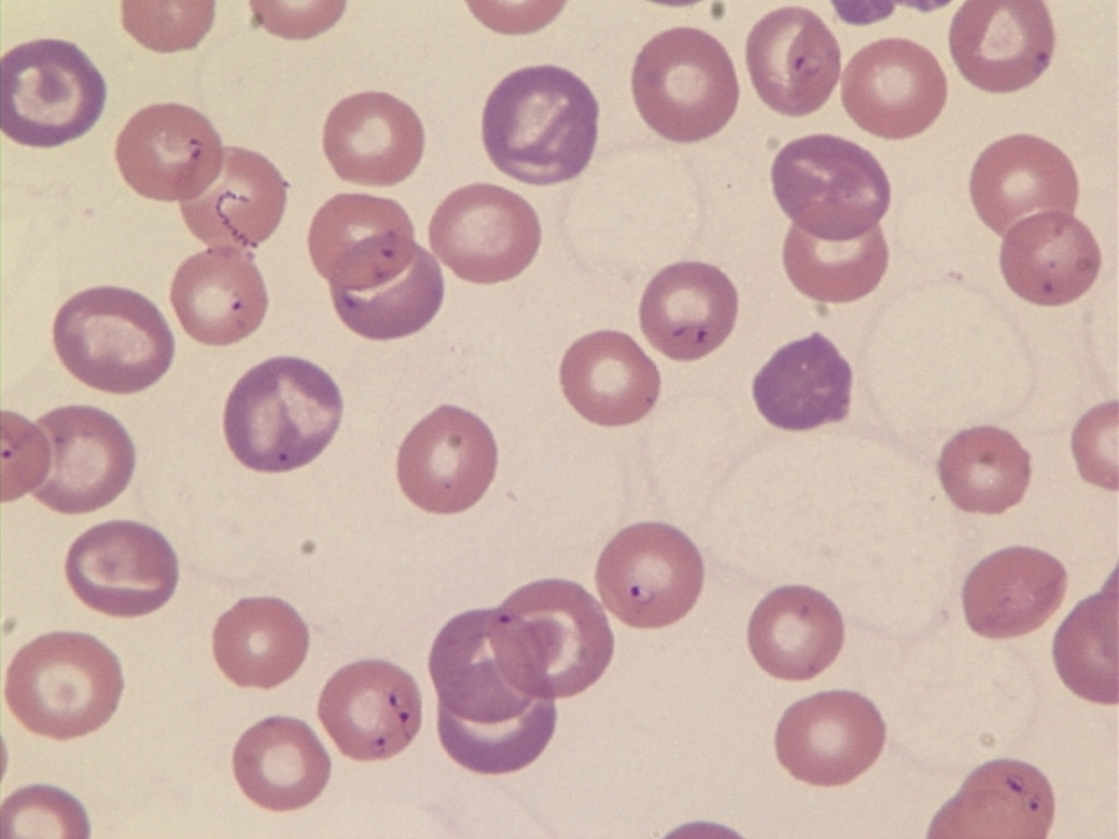 犬巴贝斯焦虫病