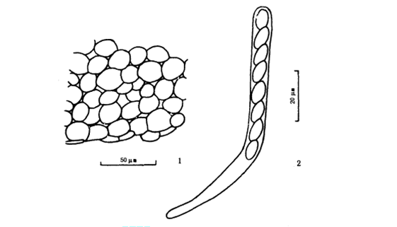 子囊盘盘状,具长柄,直径3-5mm,子实层污橙色至粉黄色,子层托与子实层