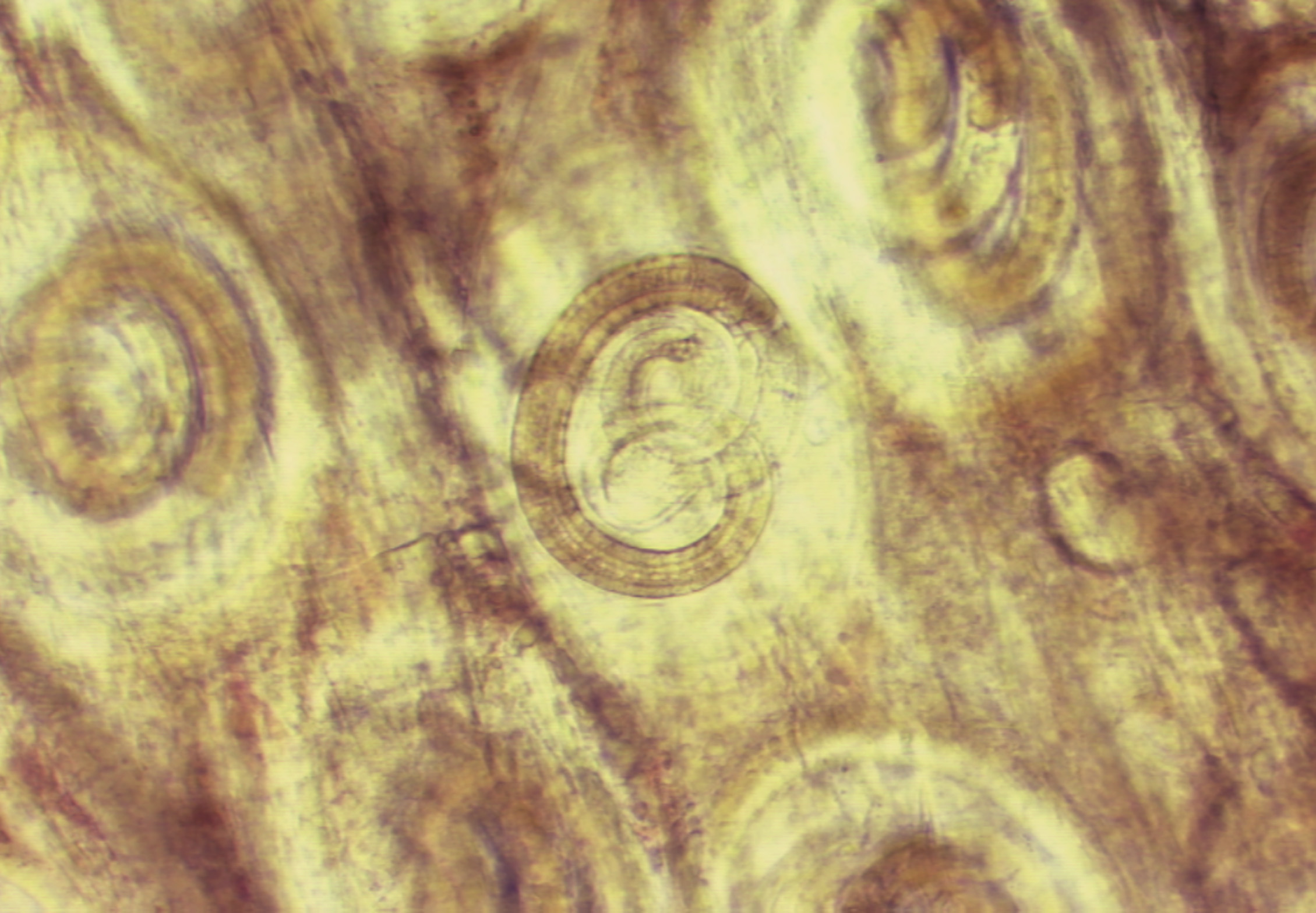  p>旋毛虫 a href="#" data-lemmaid="2697752">幼虫寄生 /a>于肌纤维