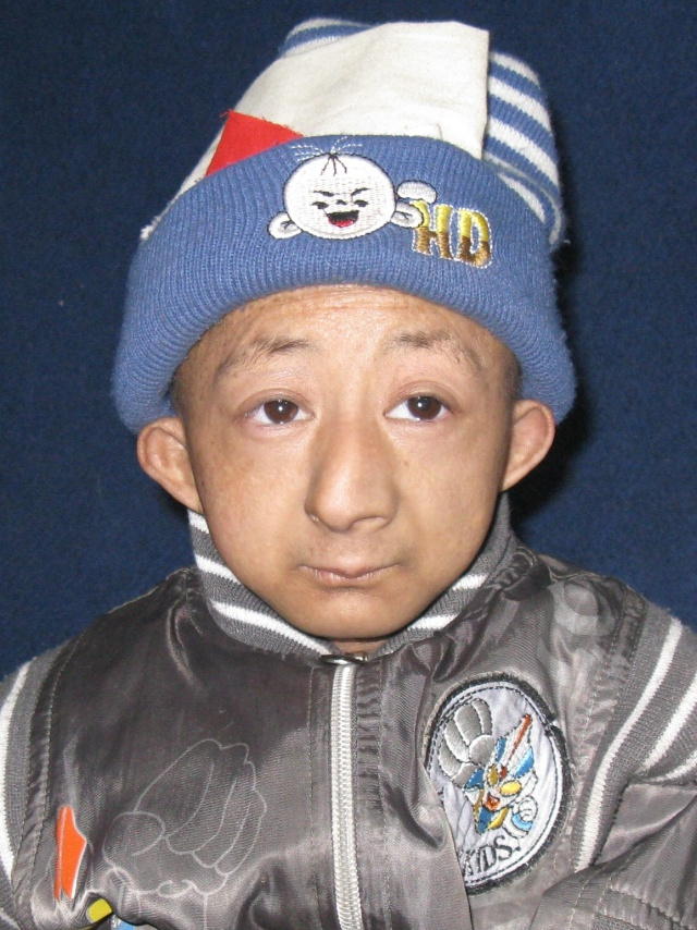  p data-id="go0etz66pp">袖珍矮人何平平(1989年6月4日～2010年3月13