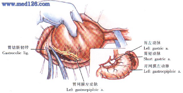 食管下段癌及贲门癌切除术
