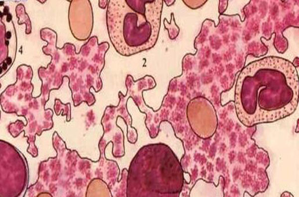 由于它的形状呈两面微凹,椭圆形或圆盘形,所以被称为血小板.