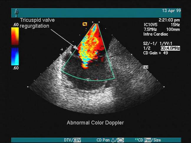  p>胎儿心脏彩超是能够帮助人们了解 a href="#" data-lemmaid="85437