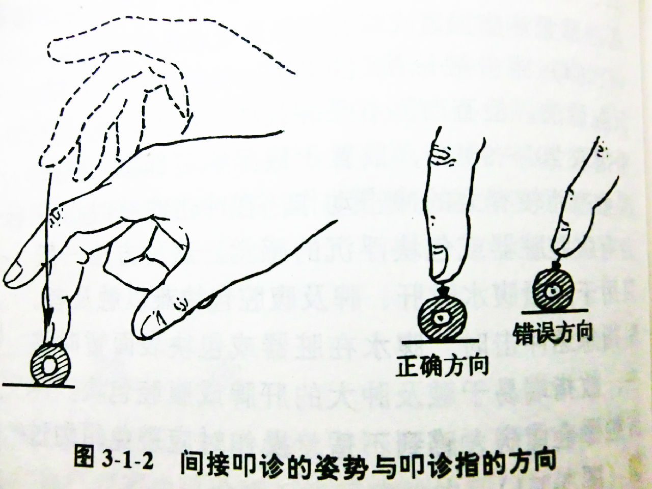 叩诊