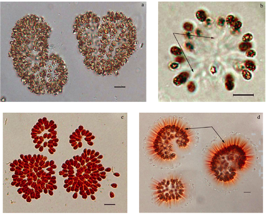  p>色球藻目(chroococcales)为 a href="#" data-lemmaid="5267149">