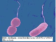  p>副溶血性弧菌(vibrio parahemolyticus),为革兰氏阴性杆菌,呈弧状