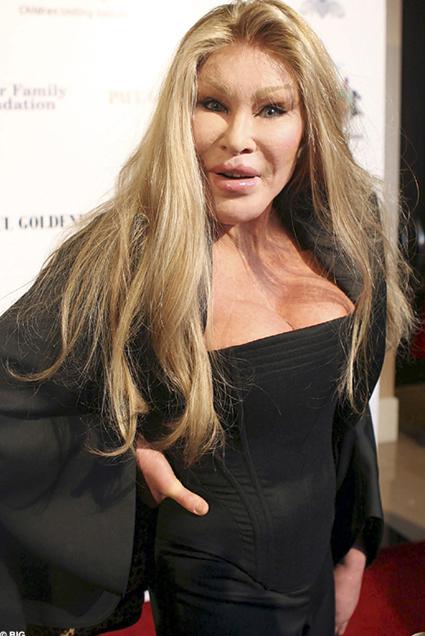 jocelyn wildenstein