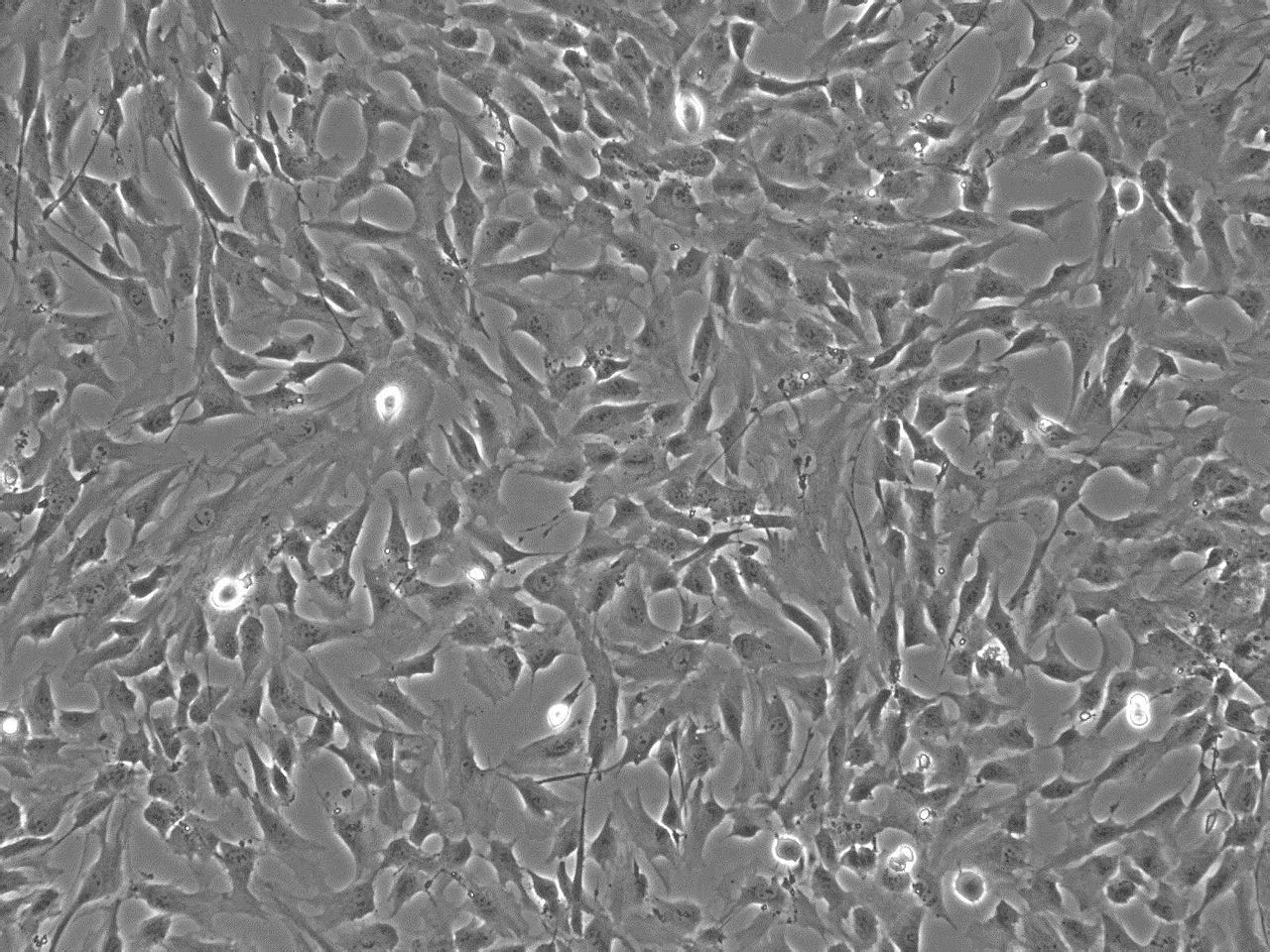 人脑血管平滑肌细胞