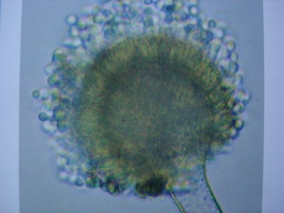 aspergillus flavus