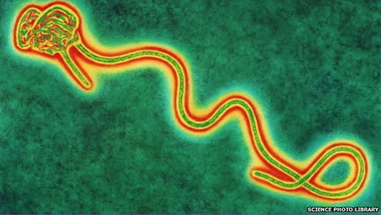 p>埃博拉病毒(ebola virus)又译作伊波拉病毒.