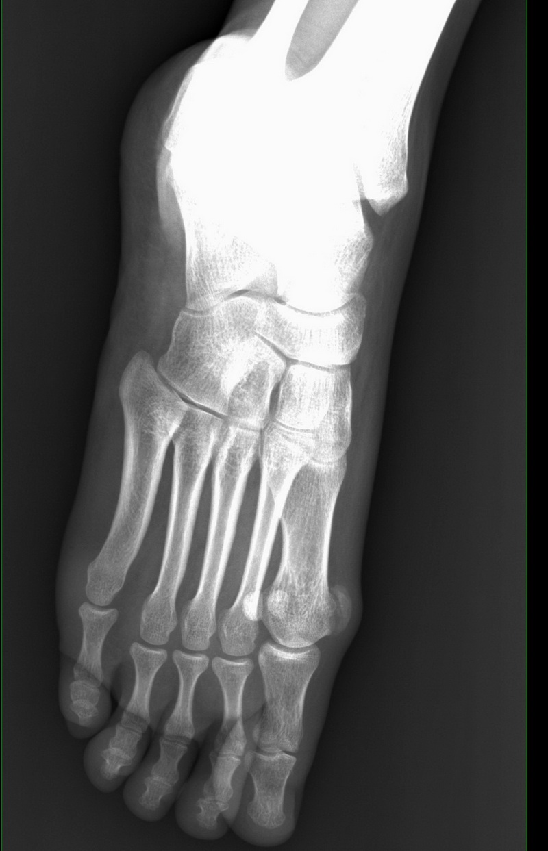  p data-id="sovgmno7zfeo">跖趾关节属椭圆关节,可作屈伸及轻微的收