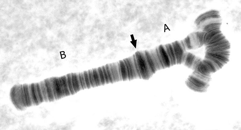 href="/item/染色体/195881" data-lemmaid="195881">染色体 /a>倒位