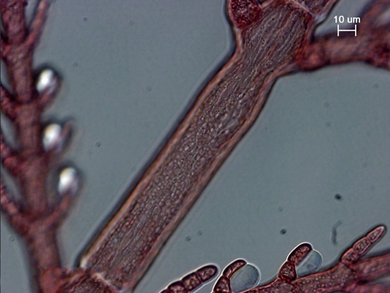  p>对丝藻的藻体纤细,丝状,丛生,由单列细胞组成,高0.5~1.