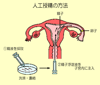 授精