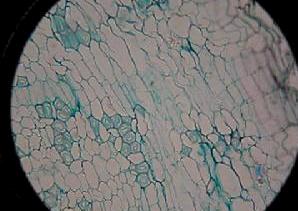  p>周皮是取代表皮的次生保护组织,存在于加粗生长的根和茎的表面,是