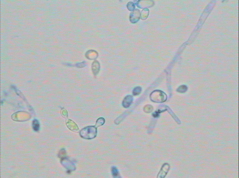  p>热带假丝酵母(candida tropicalis)即 a target="_blank" href="
