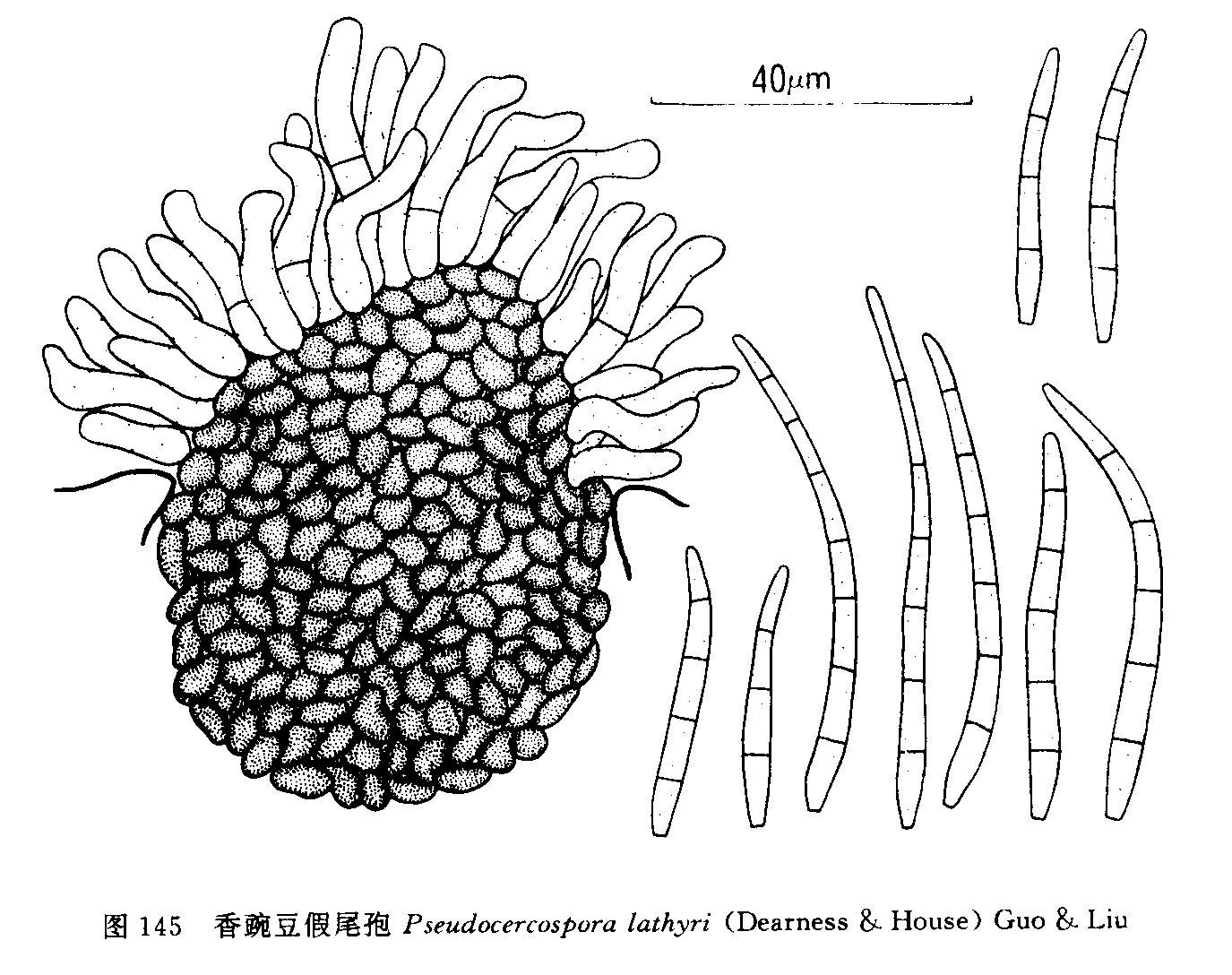  p>香豌豆假尾孢是黑霉科真菌的一种,直径2.0-8.0 mm. /p>