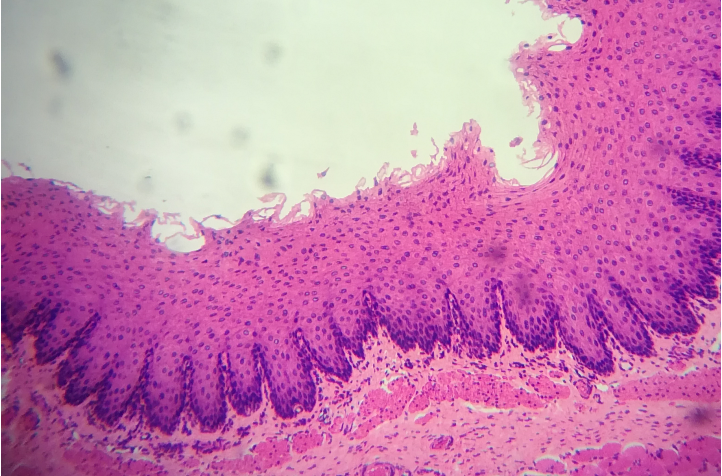  p>复层扁平上皮的细胞层次最多,仅表层的细胞为扁平状,故称复层扁平