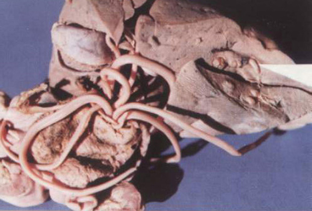  p>猪蛔虫病(ascariosis)是由猪蛔虫寄生于猪小肠引起的一种 a target