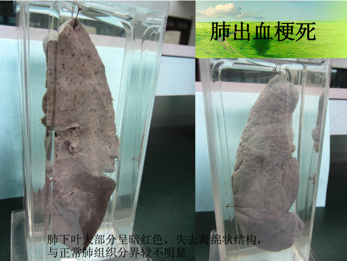  p data-id="u2aunhyr7f2v">大体标本,病理学实验教学的教学材料,病理