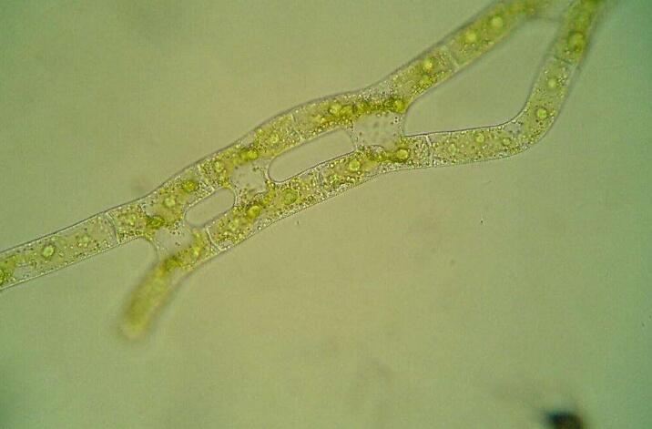  p data-id="gn6ut68eu6">冷性水绵,营养细胞宽17-20微米,长70-300