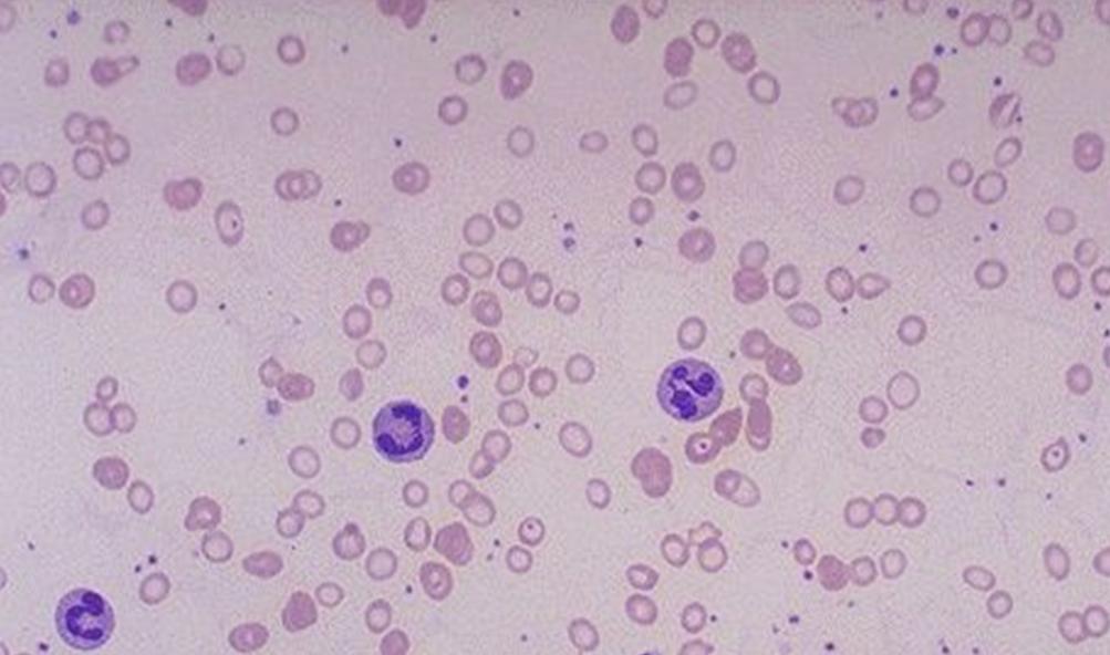 在寄生人体消化道的线虫中,钩虫的危害性最严重,由于钩虫的 a href="