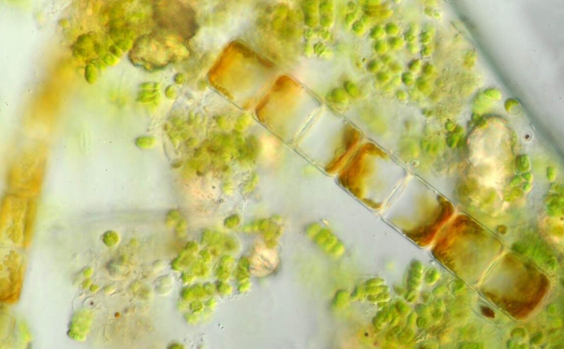  p data-id="gn6ut68eu6">冷性水绵,营养细胞宽17-20微米,长70-300