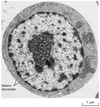  p data-id="gnx0rj3h5l">核仁(nucleolus) 通常表现为单一或多个匀质
