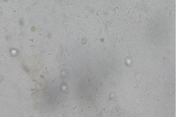 毒害艾美耳球虫