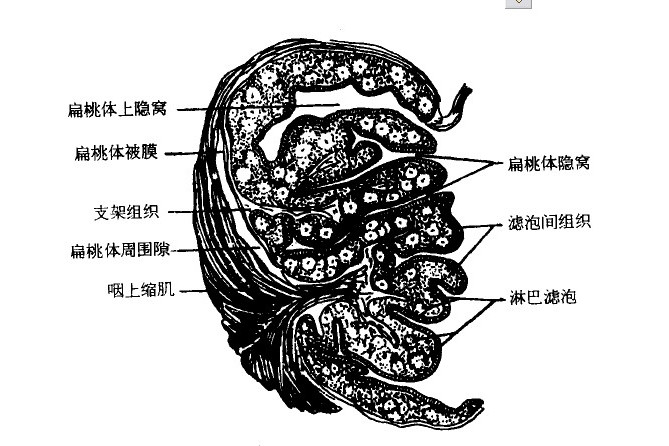 扁桃体隐窝