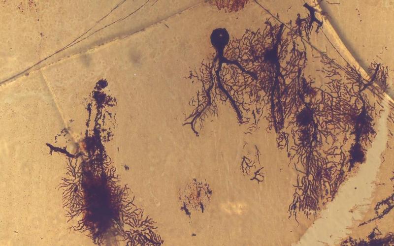  p>浦肯野细胞(purkinje cell)是从 a href="#" data-lemmaid="