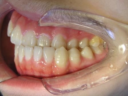  p> a target="_blank" href="/item/偏颌畸形/4981260" data-lemmaid