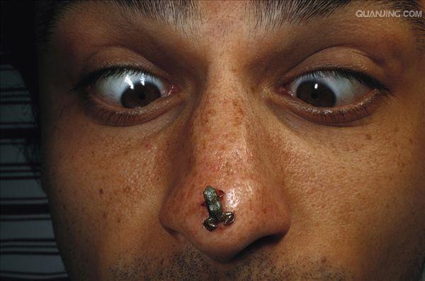  p>蟾蜍,也叫 a target="_blank" href="/item/蛤蟆">蛤蟆 /a>há ma