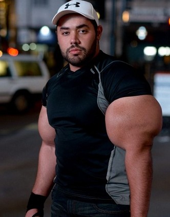  p>肱二头肌(musculus biceps brachii)位于 a href="#" data-lemmaid